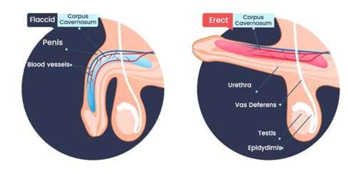 Do Blood Thinners Help with Erectile Dysfunction?