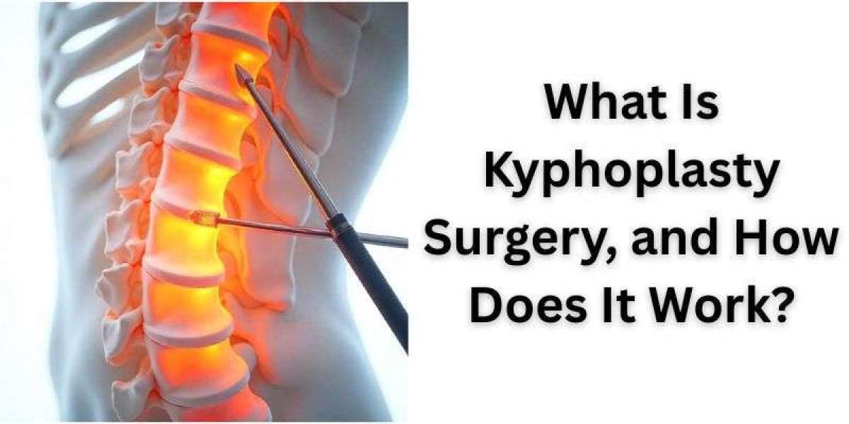 What Is Kyphoplasty Surgery, and How Does It Work?