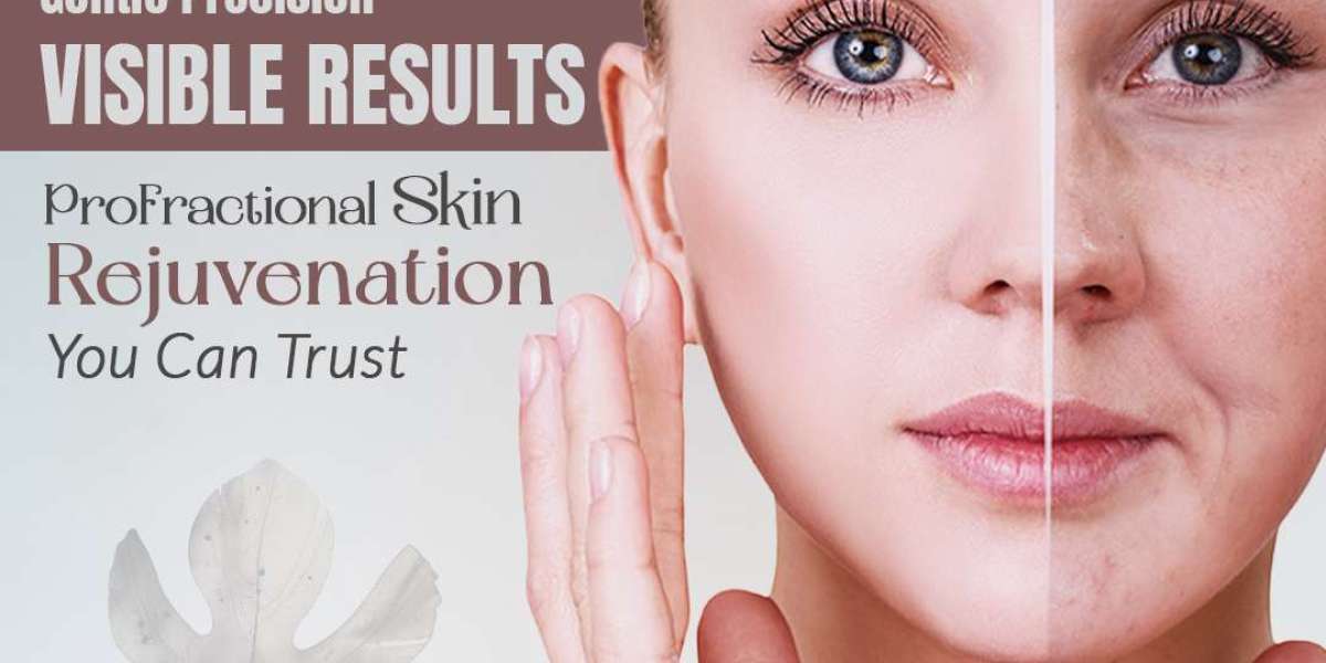 Discover the Power of Laser Liposuction in Chicago