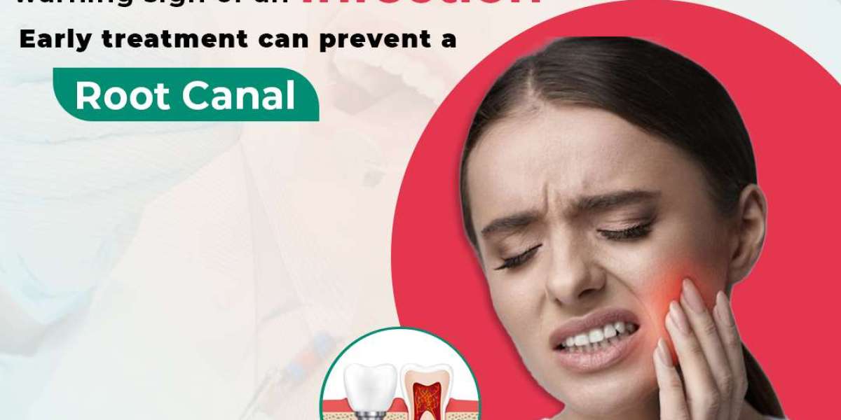 Dental Prophylaxis Treatment in Hyderabad: A Preventive Step Toward Lasting Oral Health