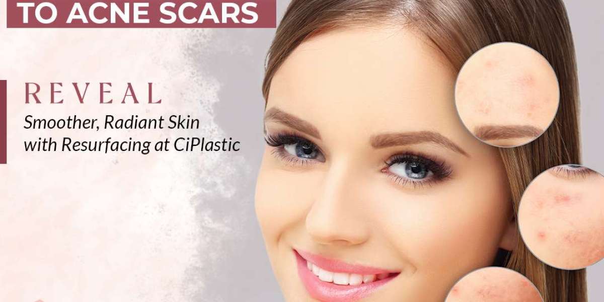Transform Your Look with Liposuction Plastic Surgery in Chicago