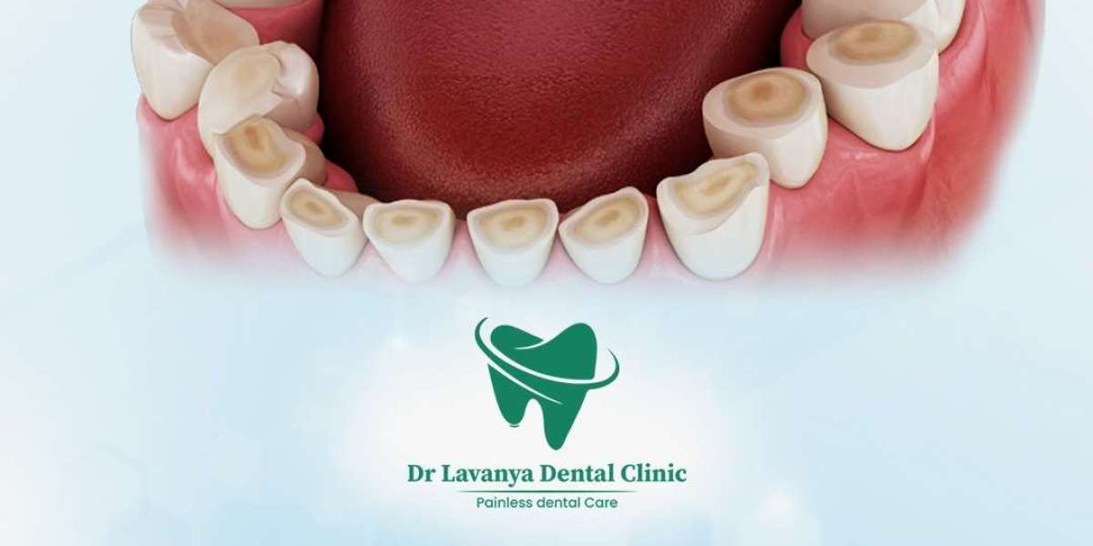 Discover the Best Dental Care Clinic in Hyderabad for a Healthier Smile