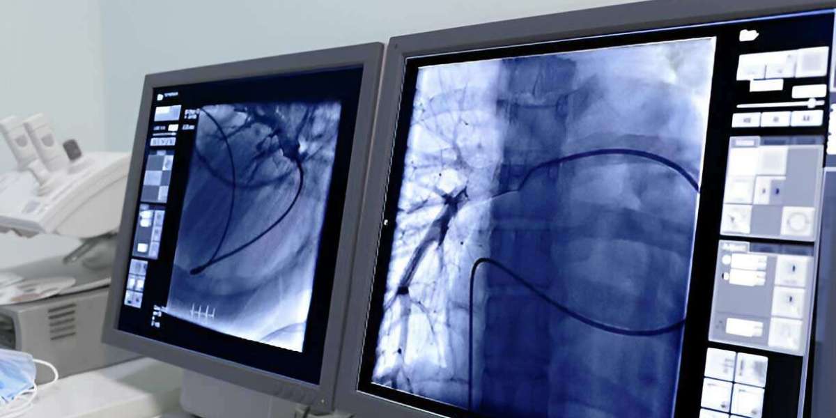 Upgrade Old X-ray Machine with Digital Flat Panel Technology