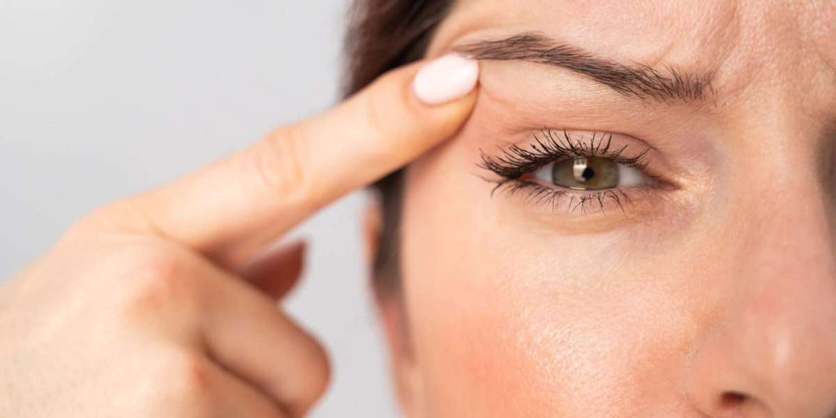 How Eyelid Surgery Can Improve Vision and Daily Comfort