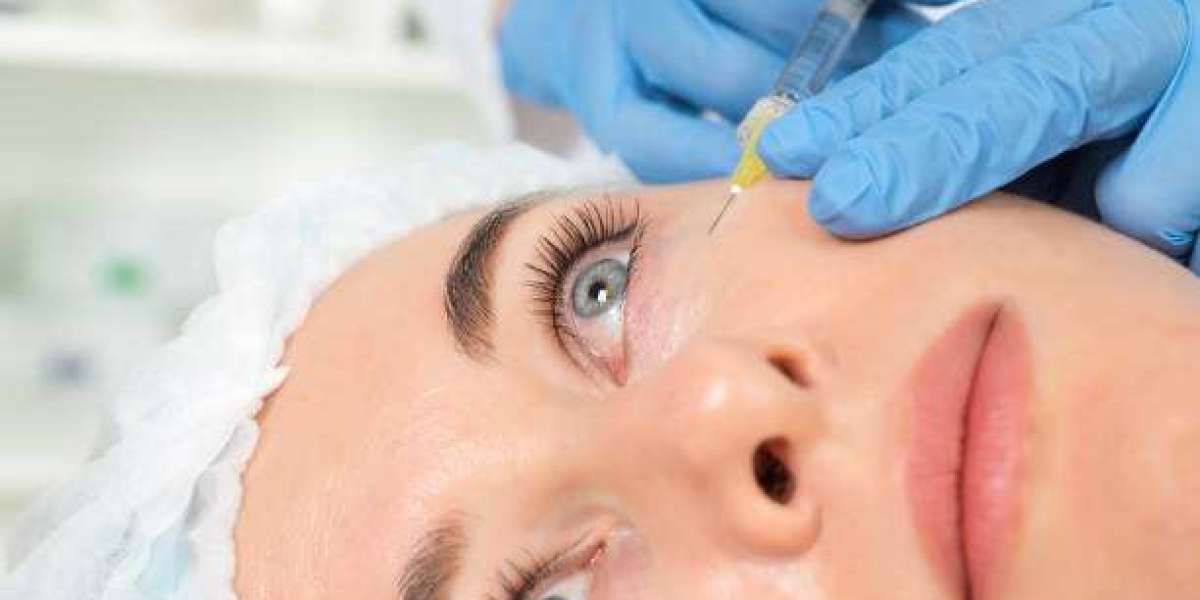 PRP for Face Treatment Experience: Patient Stories