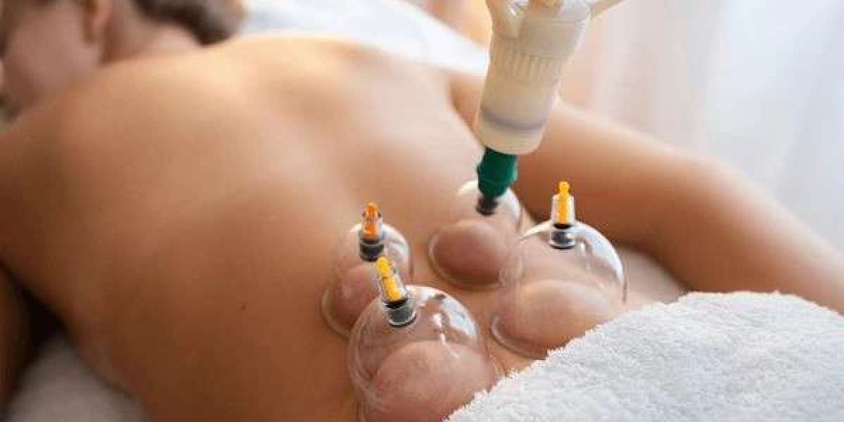 Safe, Natural, Effective: Hijama’s Role in Managing High BP