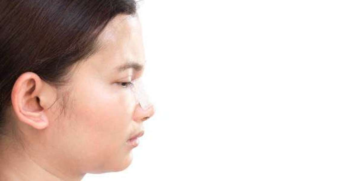 Does Double Chin Liposuction Leave Any Scars?