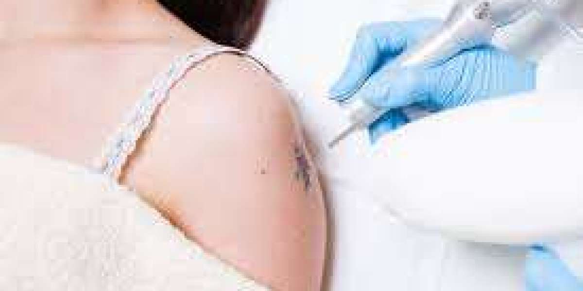 Exploring Permanent vs. Partial Results in Laser Tattoo Removal