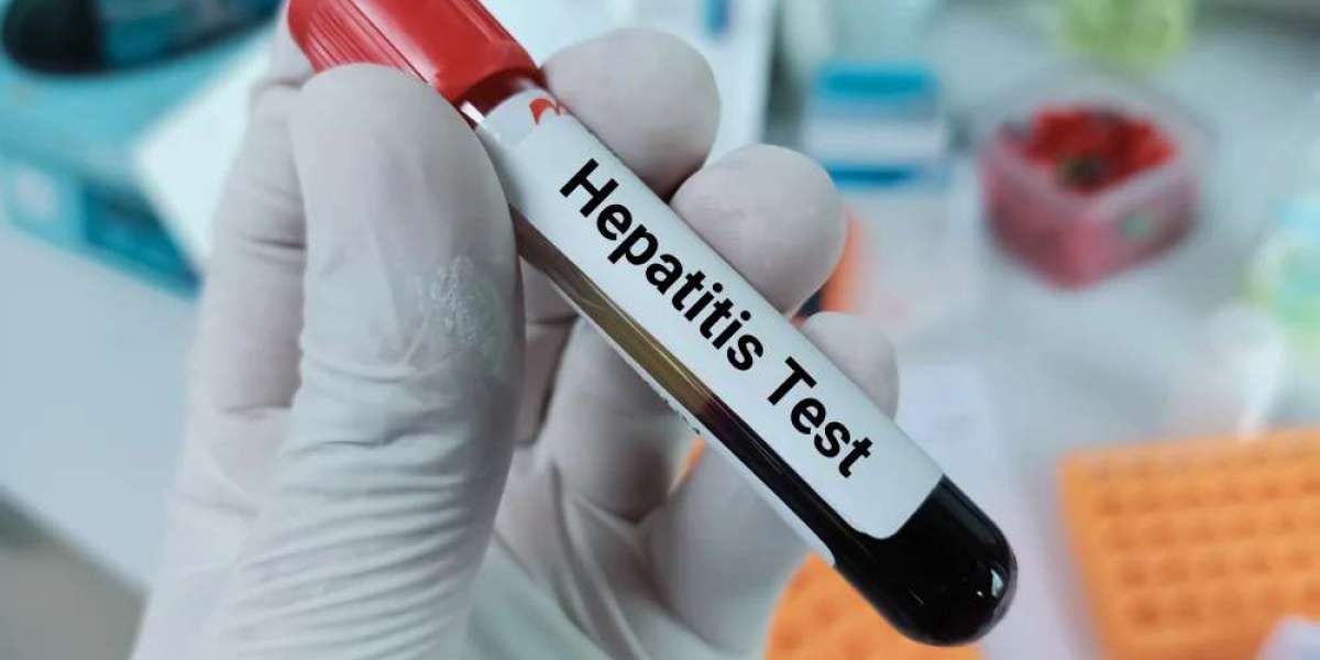 How Does Hepatitis B Testing Help Prevent Transmission?