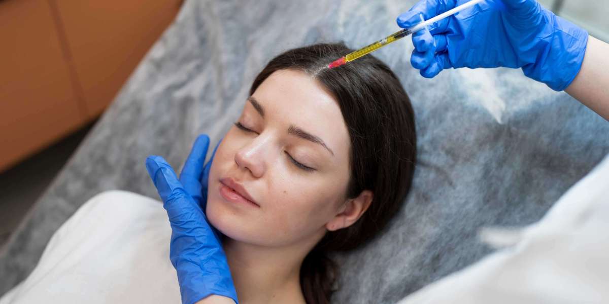 PRP Microneedling in Aesthetic Medicine Safe and Effective Skin Renewal