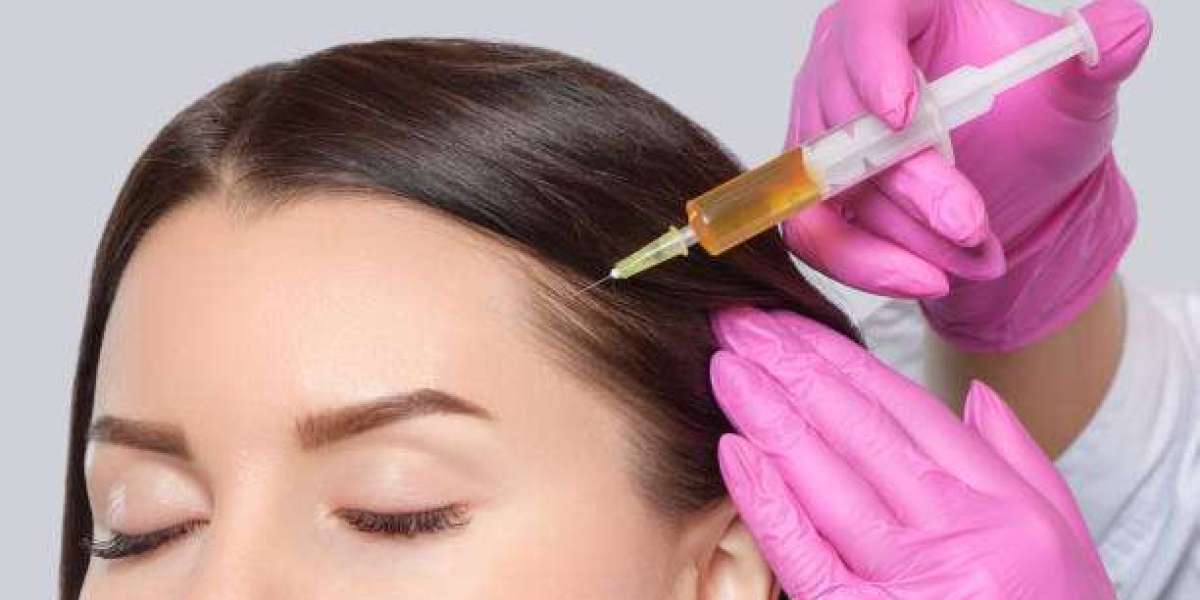 PRP Hair Treatment Revitalizes Scalp in Riyadh