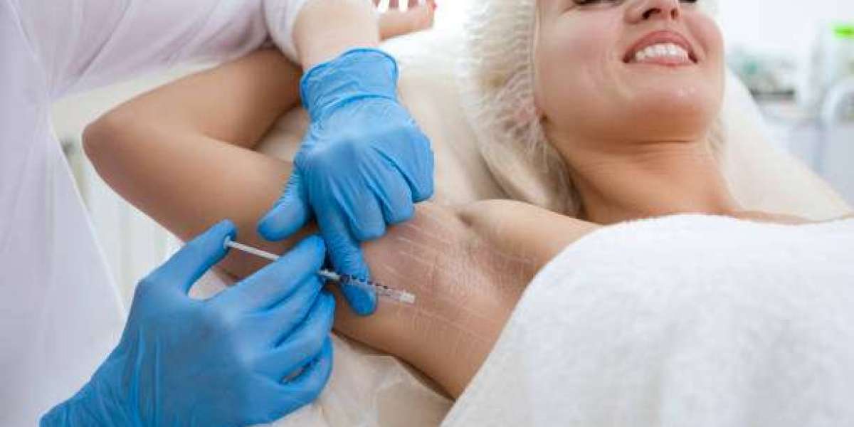 Understanding MiraDry Microwave Therapy