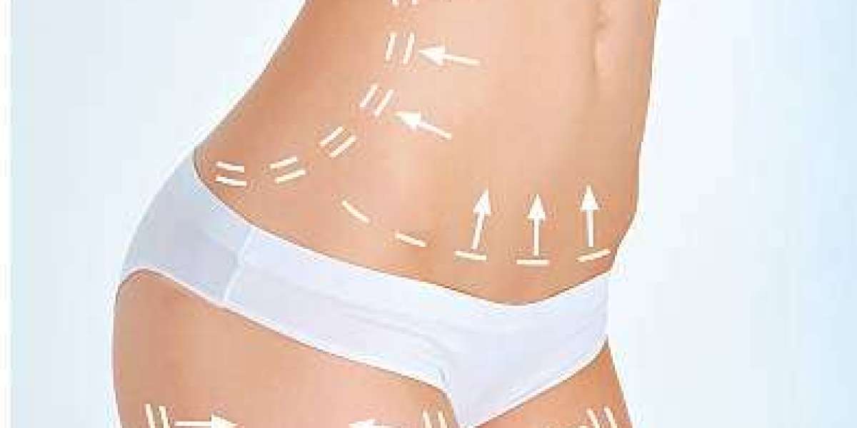 Body Sculpting Procedure Benefits for Total Body Refinement