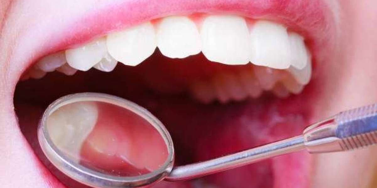 Understanding Dental Filling Cost Basics