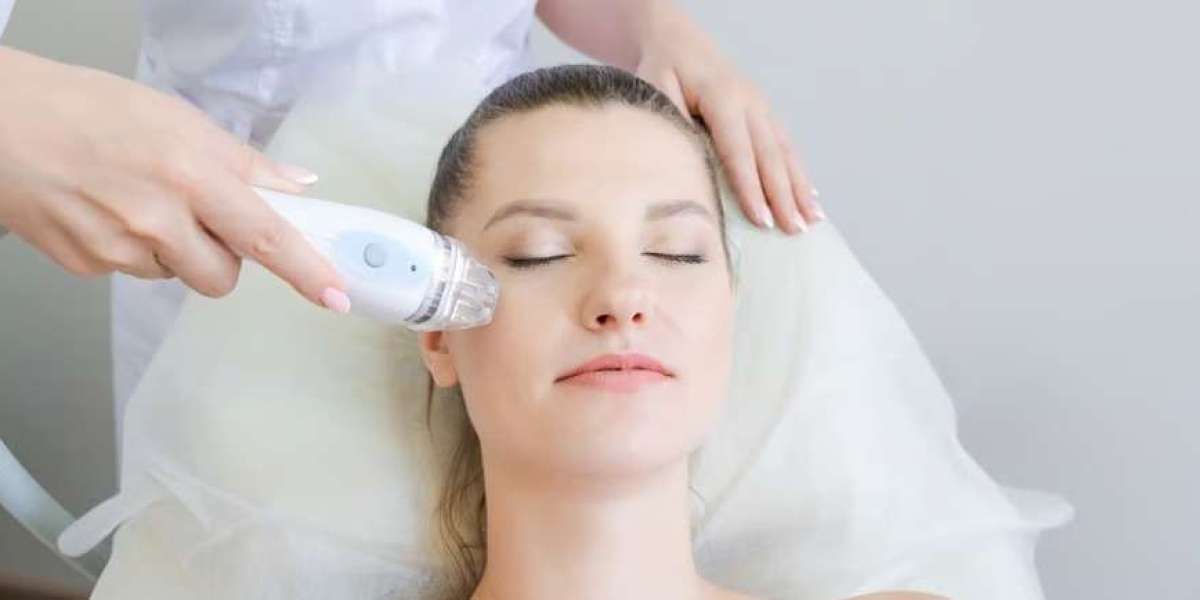 HIFU 4D Explained: The Non-Surgical Facelift Revolution