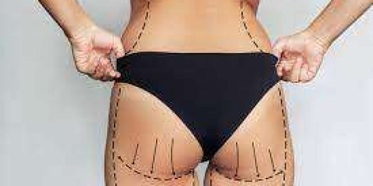 أيهما أكثر طبيعية في النتائج والمظهر النهائي؟